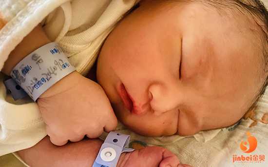 贵州供卵试管婴儿费用多少？孕两个月胎停，检查结果是21三体